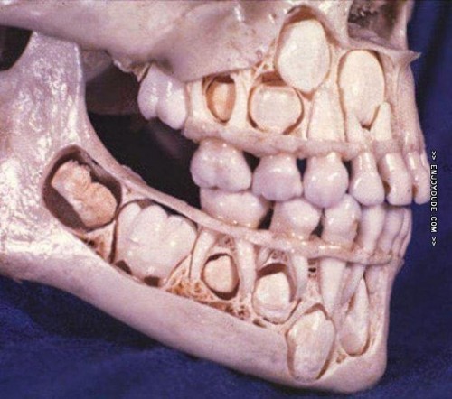 el-craneo-de-un-nino-antes-de-perder-sus-dientes-de-leche.jpg